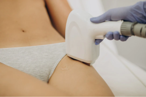 What to Expect Before Undergoing Laser Epilation