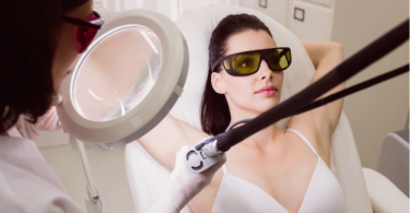 What to Expect Before Undergoing Laser Epilation