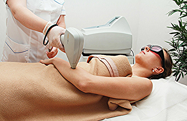Epilation Laser Avis Dermatologue