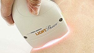 What is the Best Laser For Epilation?