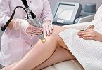 What is the Best Laser For Epilation?